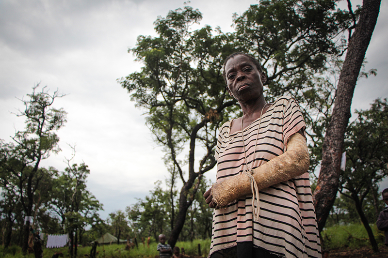 Deep scars, fragile hope for Congolese refugees in Angola